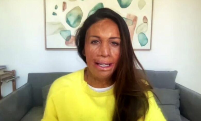Motivational speaker and best-selling author Turia Pitt launches podcast to share inspirational stories of overcoming adversity Motivational speaker and best-selling author Turia Pitt launches podcast to share inspirational stories of overcoming adversity